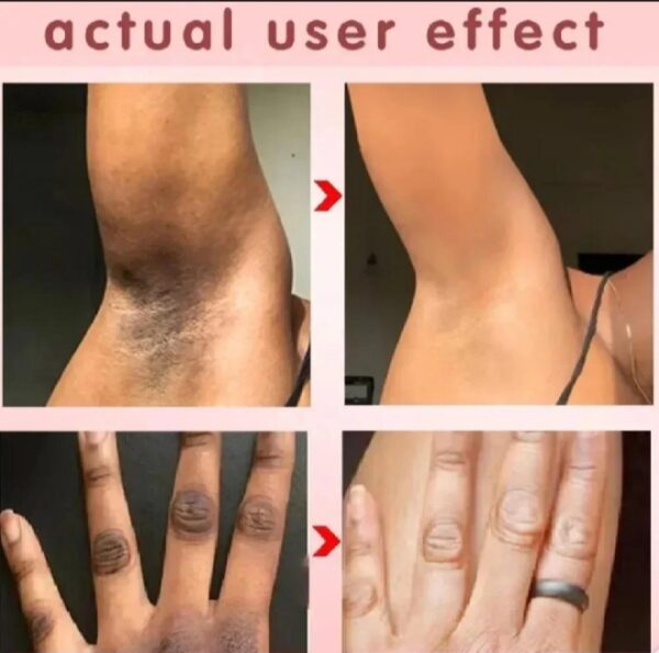Whitening Cream for Sensitive Areas - Image 4